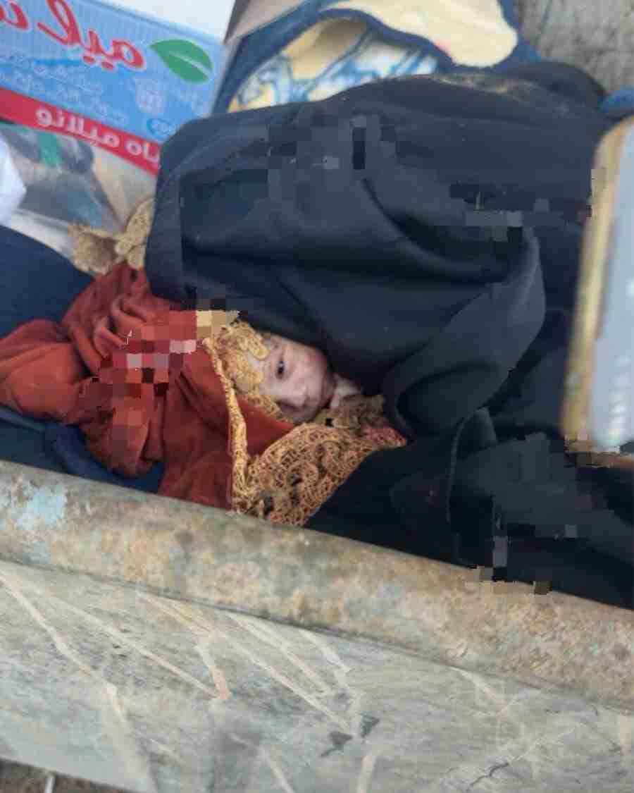 العثور على رضيع داخل حاوية نفايات في محافظة الكرك